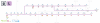 Ligne_L_plan_schema_0924.png